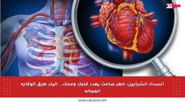انسداد الشرايين: خطر صامت يهدد قلبك ومخك.. إليك طرق الوقاية الفعالة